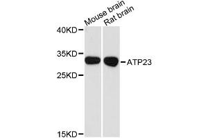 Western blot analysis of extracts of various cell lines, using ATP23 antibody. (XRCC6BP1 抗体)