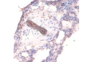Immunohistochemistry of paraffin-embedded human lung tissue using ABIN7148208 at dilution of 1:100 (COL4A1 抗体  (AA 30-167))