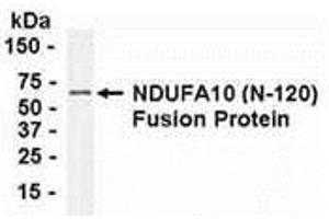 Western Blotting (WB) image for anti-NADH Dehydrogenase (Ubiquinone) 1 alpha Subcomplex, 10, 42kDa (NDUFA10) (AA 21-140) antibody (ABIN2468028) (NDUFA10 抗体  (AA 21-140))