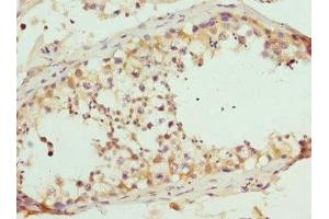 Immunohistochemistry of paraffin-embedded human testis tissue using ABIN7167404 at dilution of 1:100 (RASGRF1 抗体  (AA 1-190))
