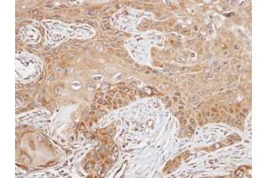 IHC-P Image Immunohistochemical analysis of paraffin-embedded SCC15 xenograft, using FAST, antibody at 1:100 dilution.
