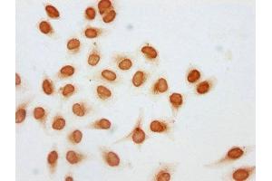Immunocytochemistry analysis of ABIN7139195 diluted at 1:5 and staining in Hela cells (treated with 30mM sodium butyrate for 4h) performed on a Leica BondTM system. (HIST1H2AG 抗体  (acLys74))