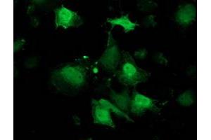 Anti-RBP1 mouse monoclonal antibody (ABIN2454467) immunofluorescent staining of COS7 cells transiently transfected by pCMV6-ENTRY RBP1 (RC214515). (RBP1 抗体)