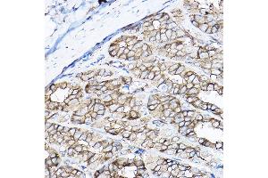 Immunohistochemistry of paraffin-embedded rat stomach using GNB2 Rabbit pAb  at dilution of 1:100 (40x lens). (GNB2 抗体  (AA 1-340))