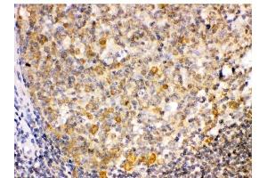 IHC analysis of TRIB2 using anti-TRIB2 antibody (ABIN3044555).