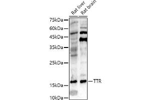 Western blot analysis of extracts of various cell lines, using TTR antibody (ABIN3021473, ABIN3021474, ABIN3021475 and ABIN6215107) at 1:500 dilution. (TTR 抗体  (AA 21-147))