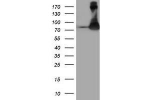 Western Blotting (WB) image for anti-F-Box Protein 21 (FBXO21) antibody (ABIN1498231) (FBXO21 抗体)