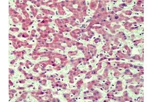 Human Liver: Formalin-Fixed, Paraffin-Embedded (FFPE) (IRAK4 抗体  (N-Term))
