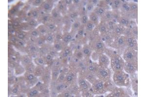 DAB staining on IHC-P; Samples: Mouse Liver Tissue (ACAA1 抗体  (AA 182-424))