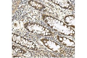 IHC analysis of Aconitase 1/ACO1 using anti-Aconitase 1/ACO1 antibody (ABIN7598988).