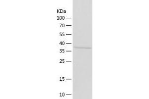 Aminomethyltransferase Protein (AMT) (AA 29-403) (His tag)