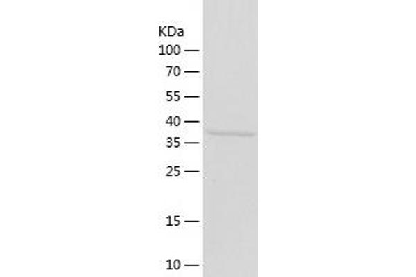 Aminomethyltransferase Protein (AMT) (AA 29-403) (His tag)