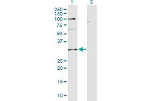 Western Blot analysis of C10orf63 expression in transfected 293T cell line by C10orf63 monoclonal antibody (M05), clone 3E8. (ENKUR 抗体  (AA 1-256))