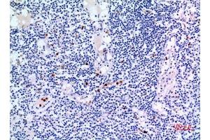 Immunohistochemistry (IHC) analysis of paraffin-embedded Human Lymph Gland, antibody was diluted at 1:100. (IDH3A 抗体  (Internal Region))