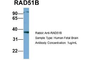 Host: Rabbit  Target Name: RAD51B  Sample Tissue: Human Fetal Brain  Antibody Dilution: 1. (RAD51 Homolog B 抗体  (Middle Region))