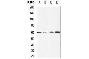 Western blot analysis of CDC25C expression in A431 (A), MCF7 (B), mouse kidney (C), rat heart (D) whole cell lysates. (CDC25C 抗体  (Center))
