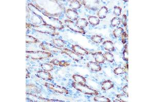Immunohistochemistry of paraffin-embedded mouse kidney using LONP1 Rabbit pAb (ABIN1680707, ABIN3018785, ABIN3018786 and ABIN6220576) at dilution of 1:100 (40x lens). (LONP1 抗体  (AA 120-400))