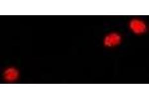 Immunofluorescent analysis of GADD45 alpha staining in A549 cells. (GADD45A 抗体)