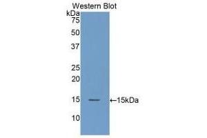 Detection of Recombinant DAO, Human using Polyclonal Antibody to Amiloride Binding Protein 1 (ABP1) (DAO 抗体  (AA 347-466))