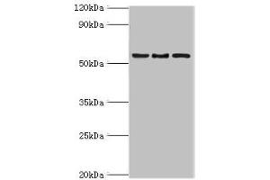 Western blot All lanes: ARFGAP3 antibody at 4 μg/mL Lane 1: HepG2 whole cell lysate Lane 2: Jurkat whole cell lysate Lane 3: A549 whole cell lysate Secondary Goat polyclonal to rabbit IgG at 1/10000 dilution Predicted band size: 57, 52 kDa Observed band size: 57 kDa (ARFGAP3 抗体  (AA 217-516))