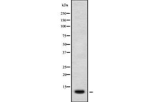 Western blot analysis of CXCL11 using HuvEc whole cell lysates (CXCL11 抗体  (Internal Region))