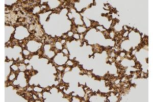 ABIN6277609 at 1/100 staining Mouse lung tissue by IHC-P. (RFC4 抗体)