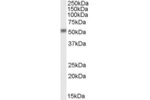 Image no. 1 for anti-STEAP Family Member 4 (STEAP4) (C-Term) antibody (ABIN375107) (STEAP4 抗体  (C-Term))