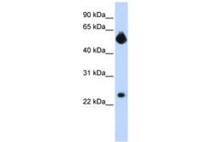 Image no. 1 for anti-Notch 4 (NOTCH4) (Internal Region) antibody (ABIN6742248) (NOTCH4 抗体  (Internal Region))
