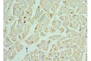 Immunohistochemistry of paraffin-embedded human heart tissue using ABIN7145306 at dilution of 1:100 (BCL2L13 抗体  (AA 1-300))
