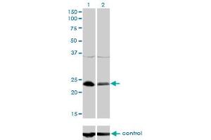 Western blot analysis of NFYB over-expressed 293 cell line, cotransfected with NFYB Validated Chimera RNAi (Lane 2) or non-transfected control (Lane 1). (NFYB 抗体  (AA 1-207))