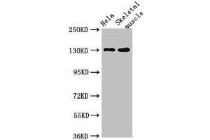 Western Blot Positive WB detected in: Hela whole cell lysate, Mouse skeletal muscle tissue All lanes: PER3 antibody at 4 μg/mL Secondary Goat polyclonal to rabbit IgG at 1/50000 dilution Predicted band size: 132, 133 kDa Observed band size: 132 kDa (PER3 抗体  (AA 1-131))