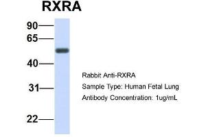 Host:  Rabbit  Target Name:  RXRA  Sample Type:  Human Fetal Lung  Antibody Dilution:  1. (Retinoid X Receptor alpha 抗体  (N-Term))