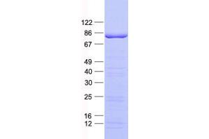 Validation with Western Blot