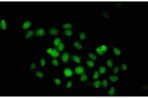 Immunofluorescence staining of Hela cells with ABIN7149530 at 1:233, counter-stained with DAPI. (DND1 抗体  (AA 37-180))