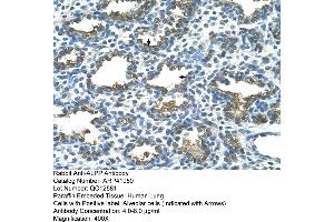 Rabbit Anti-ALPP Antibody  Paraffin Embedded Tissue: Human Lung Cellular Data: Alveolar cells Antibody Concentration: 4. (PLAP 抗体  (C-Term))