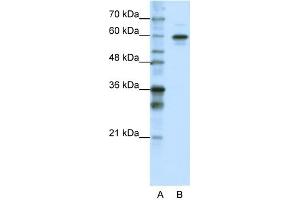 WB Suggested Anti-HNRPLL Antibody Titration:  1. (HNRPLL 抗体  (N-Term))