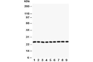 Western blot testing of SOD2 antibody and Lane 1:  rat liver;  2: (r) intestine;  3: (r) lung;  4: (r) heart;  5: human SMMC-7721;  6: (h) HeLa;  7: (h) COLO320;  8: (h) SW620;  9: (h) A549 cell lysate. (SOD2 抗体  (N-Term))
