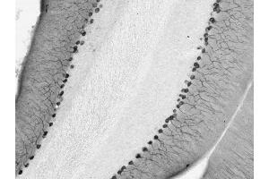 Cerebellum immunohistochemistry. (DLG2 抗体  (AA 1-852))
