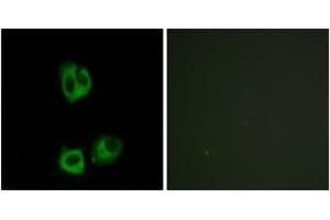 Immunofluorescence analysis of HeLa cells, using Lck (Phospho-Tyr393) Antibody. (LCK 抗体  (pTyr394))