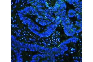 IF analysis of Integrin beta 4/ITGB4 using anti-Integrin beta 4/ITGB4 antibody (ABIN7601135). (Integrin beta 4 抗体  (AA 29-431))