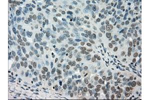 Immunohistochemical staining of paraffin-embedded Ovary tissue using anti-STK39mouse monoclonal antibody. (STK39 抗体)
