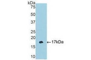 Detection of Recombinant TBX3, Human using Polyclonal Antibody to T-Box Protein 3 (TBX3) (TBX3 抗体  (AA 107-220))