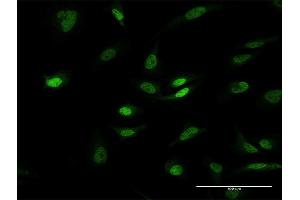Immunofluorescence of purified MaxPab antibody to PHC1 on HeLa cell. (PHC1 抗体  (AA 1-957))