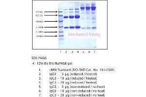 Gel Scan of Immunoglobulin G3 (IgG3), Normal Human Plasma  This information is representative of the product ART prepares, but is not lot specific. (IgG3 蛋白)