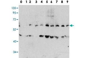Western blot analysis of MYC (phospho T58) polyclonal antibody  in human TPA activated HeLa cell line lysates. (c-MYC 抗体  (pThr58))