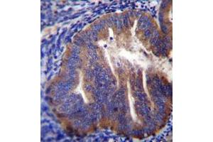 Immunohistochemistry analysis in formalin fixed and paraffin embedded human uterus tissue reacted with KLC2 Antibody (N-term) followed which was  peroxidase conjugated to the secondary antibody and followed by DAB staining. (KLC2 抗体  (N-Term))