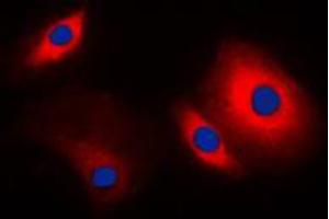 Immunofluorescent analysis of Cortactin staining in MCF7 cells. (Cortactin 抗体  (C-Term))