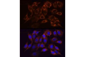 Immunofluorescence analysis of NIH/3T3 cells using NDUFS1 Rabbit pAb (ABIN7268819) at dilution of 1:50 (40x lens). (NDUFS1 抗体  (AA 80-290))