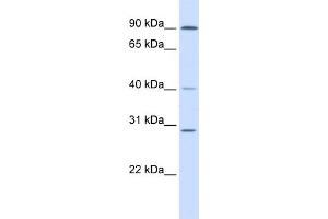 WB Suggested Anti-ERCC2 Antibody Titration:  0. (ERCC2 抗体  (N-Term))
