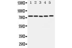 Western Blotting (WB) image for anti-ATP-Binding Cassette, Sub-Family G (WHITE), Member 1 (ABCG1) (AA 627-647), (C-Term) antibody (ABIN3044094) (ABCG1 抗体  (C-Term))